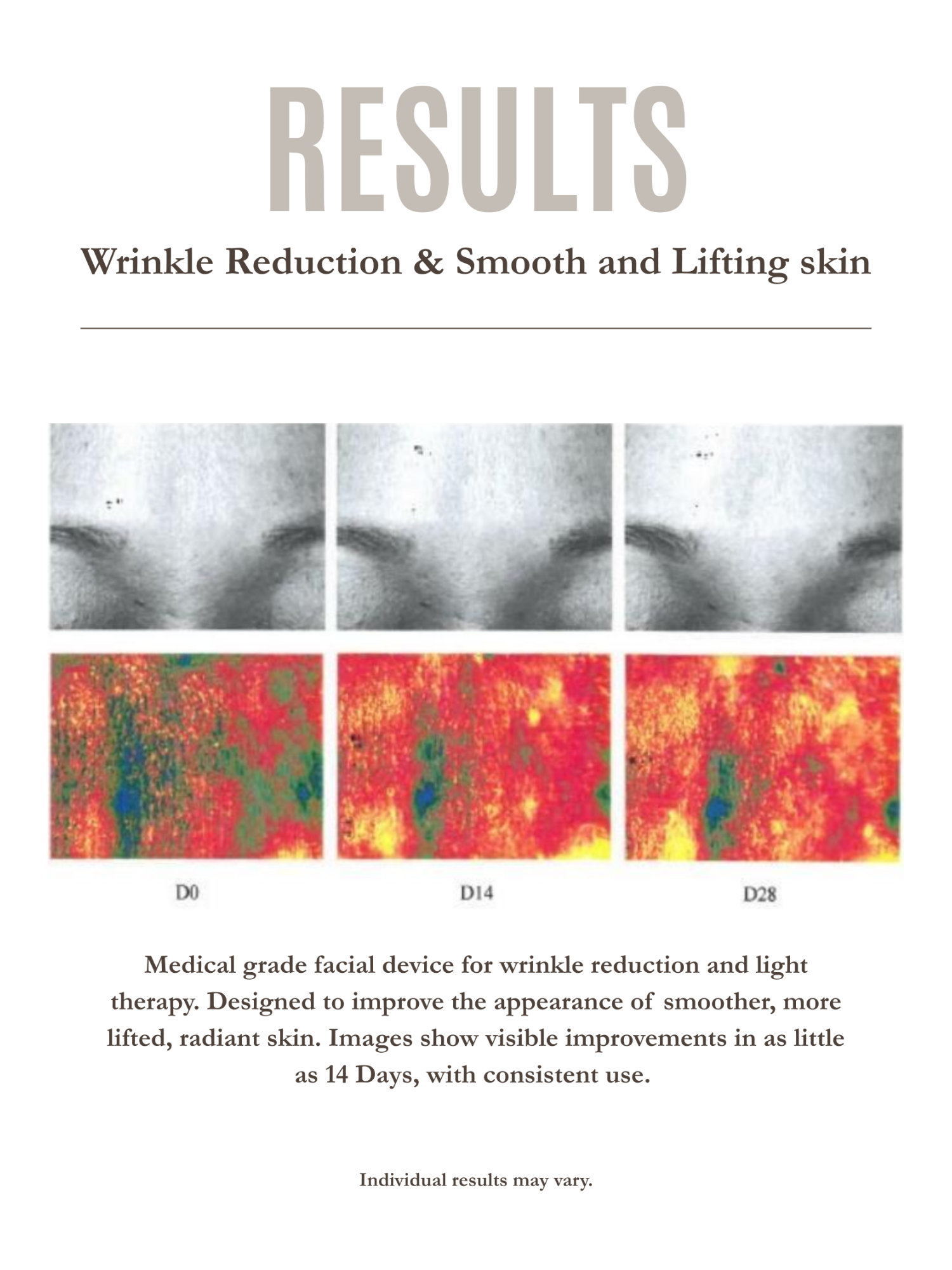 Aura-M SkinBooster Device